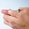 Как лечить нарывы на пальцах: разные методы терапии